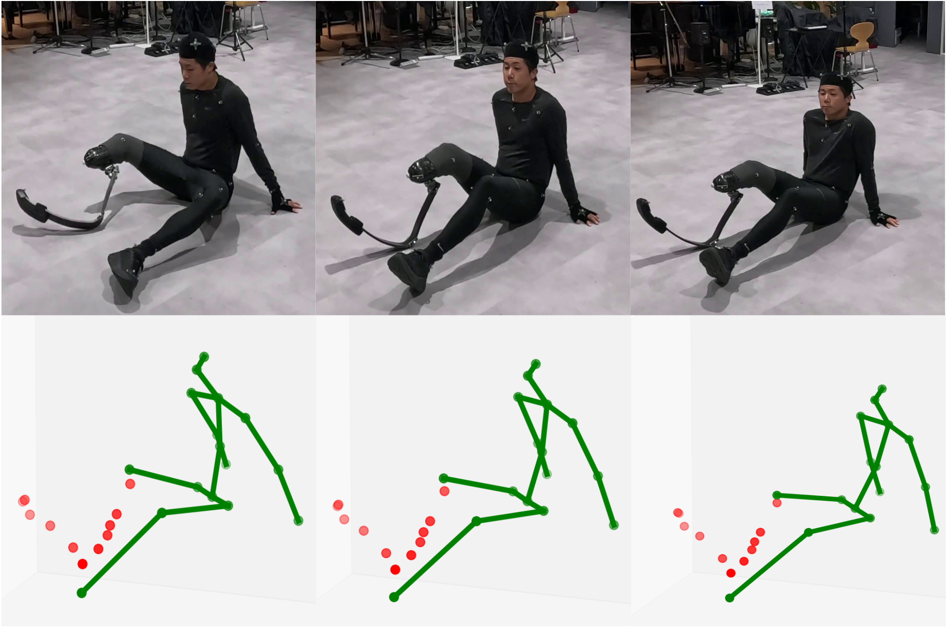 Inclusive 3D Pose Estimation for Prosthesis Users